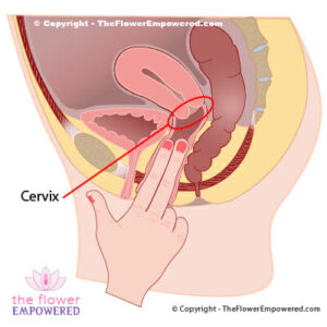 Cervix Bulge Porn - Pelvic Organ Prolapse (POP) affects 50% of women globally