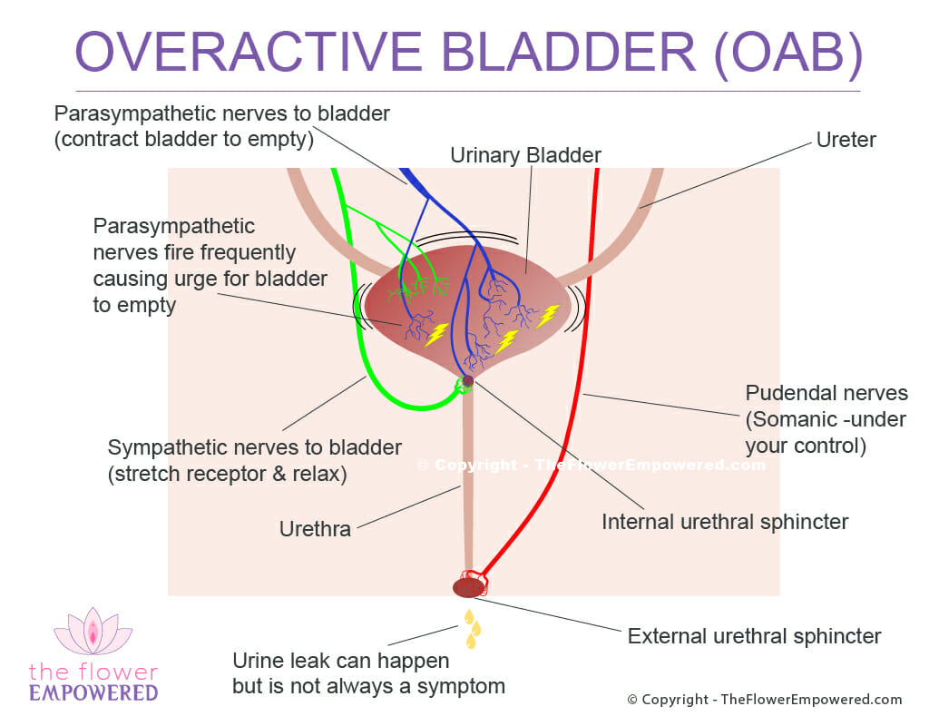 Overactive Bladder (OAB) incontinence