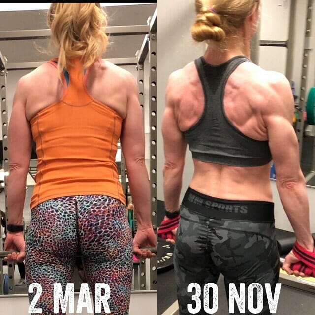 Can you lift weights with Pelvic Organ Prolapse Can you lift weights with Pelvic Organ Prolapse